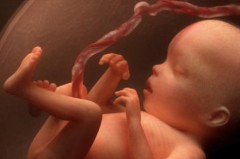foetus.jpg